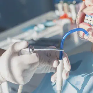 /img/25053-teeth-whitening-clear-lake-tx-dental-checkup.webp
