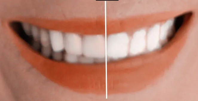 25053 teeth whitening clear lake tx professional