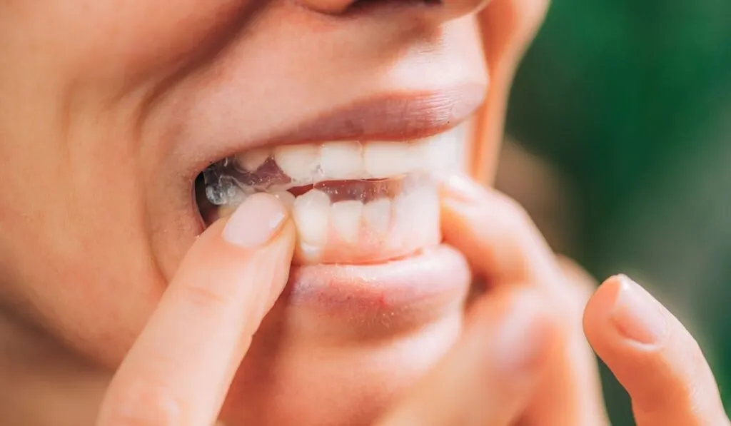 25058 teeth whitening strips