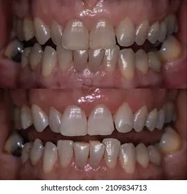 25066 office whitening foods drinks