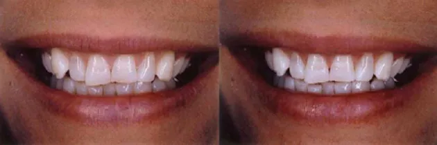 /img/25066-office-whitening-toothpaste.webp