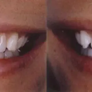 /img/25066-office-whitening-toothpaste.webp