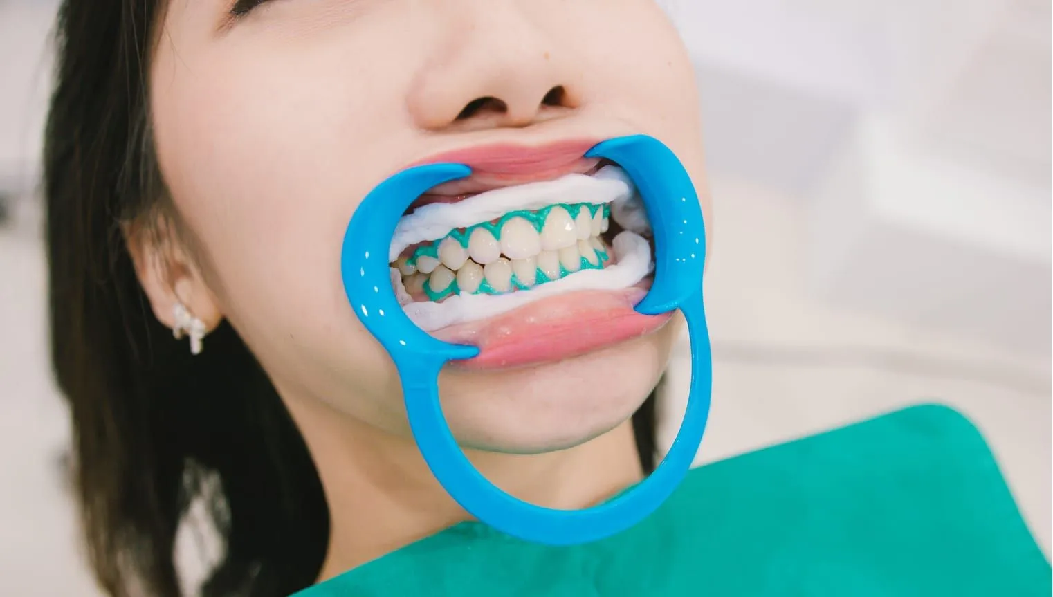 25068 oral hygiene