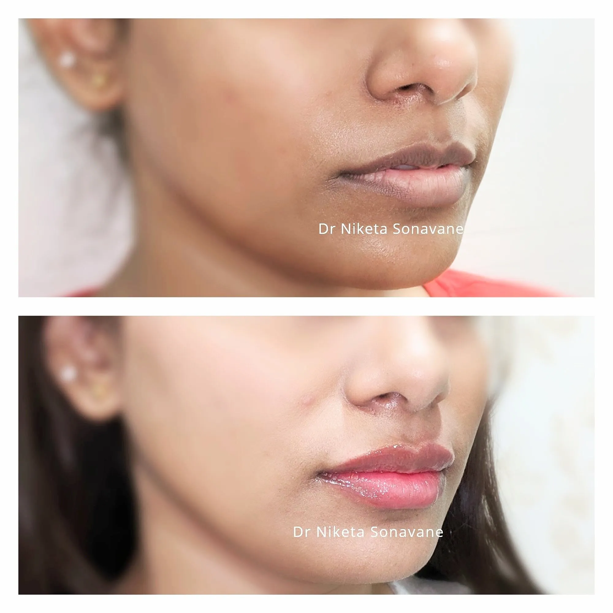 /img/25069-skin-whitening-surgery-near-me-procedure.webp