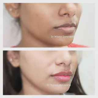 /img/25069-skin-whitening-surgery-near-me-procedure.webp