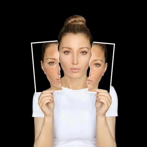 25069 skin whitening surgery near me risks