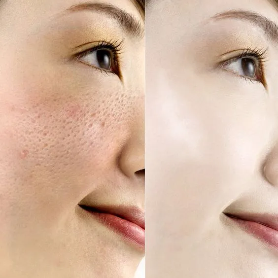 25070 topical creams skin whitening