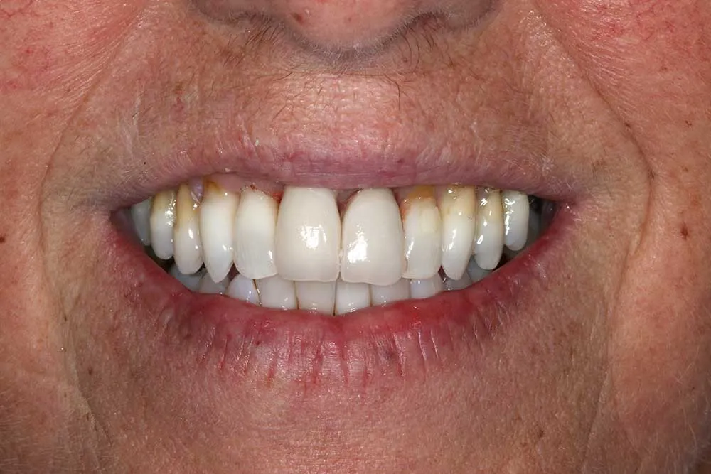 25078 professional success smile