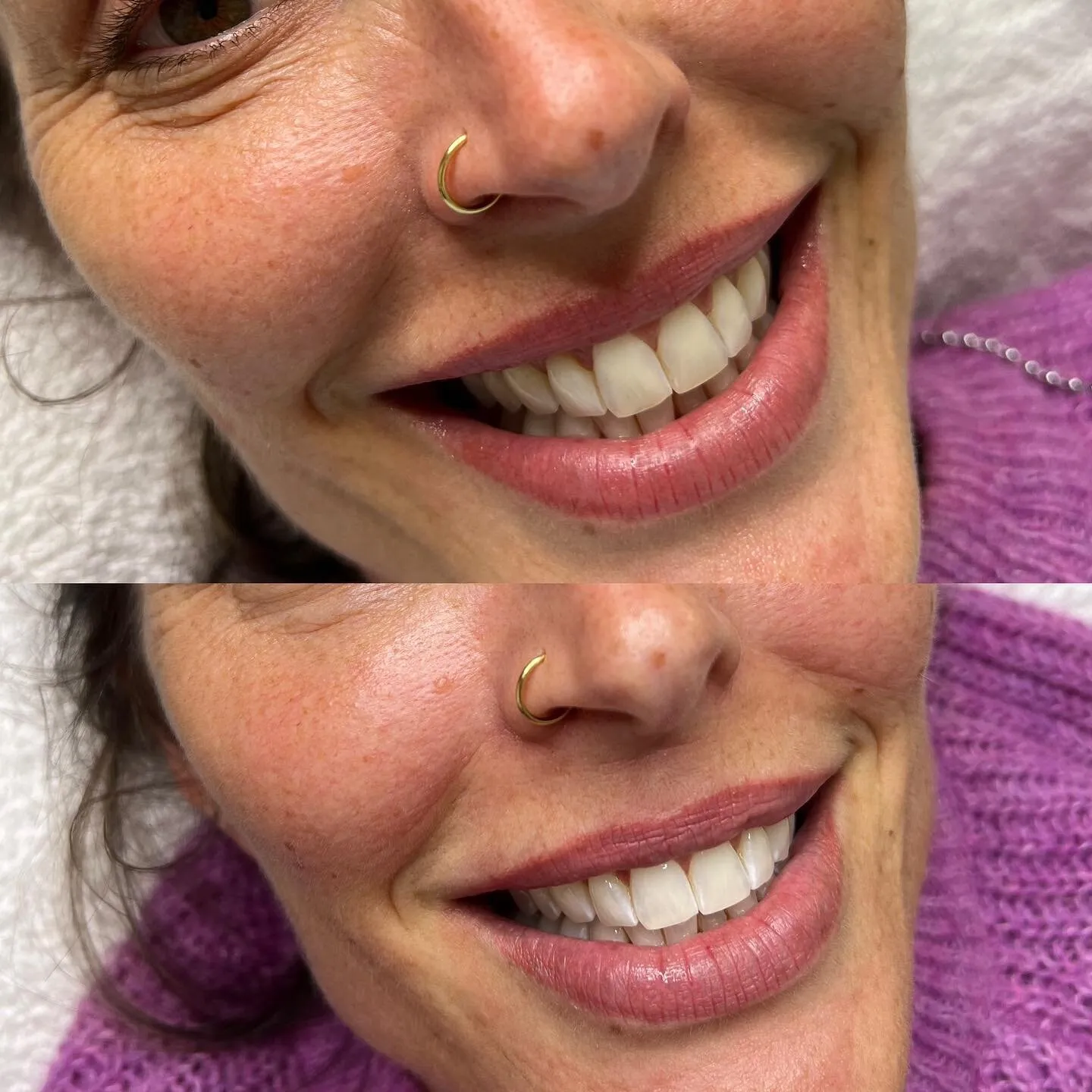 /img/25083-teeth-whitening-nsw-smiling-woman.webp