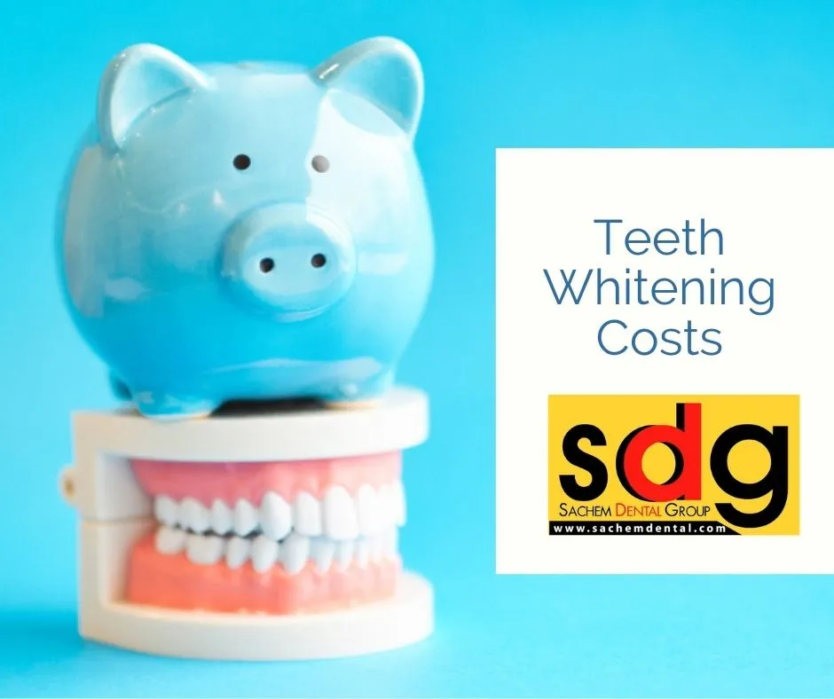 25085 discolored teeth