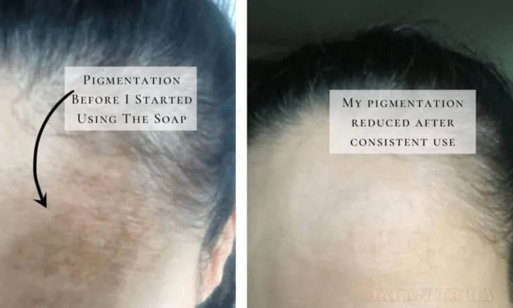 25089 whitening lotion ingredients