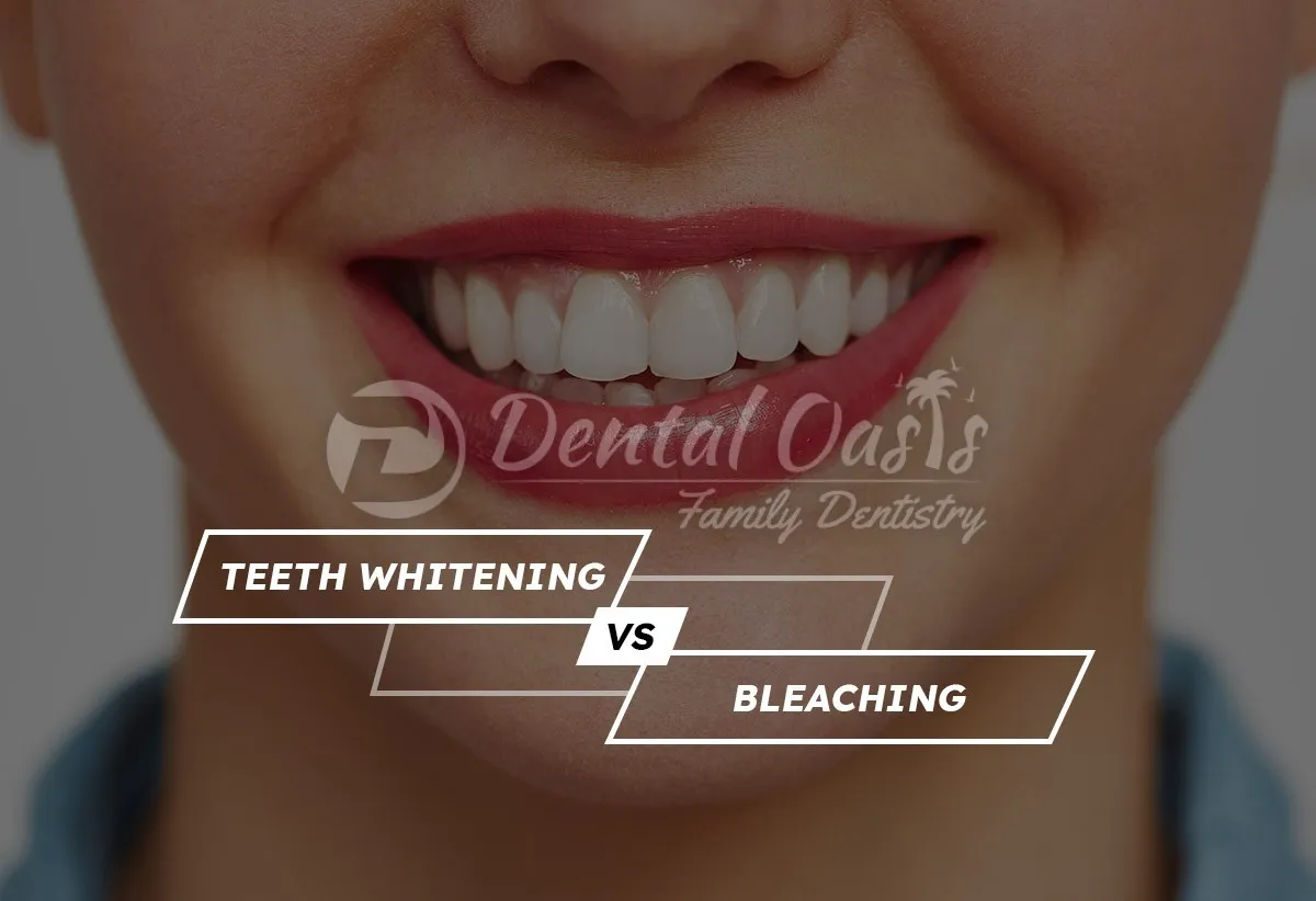 25091 professional teeth whitening