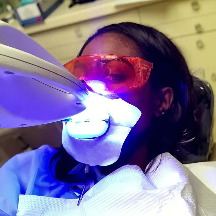 25093 laser teeth whitening machine