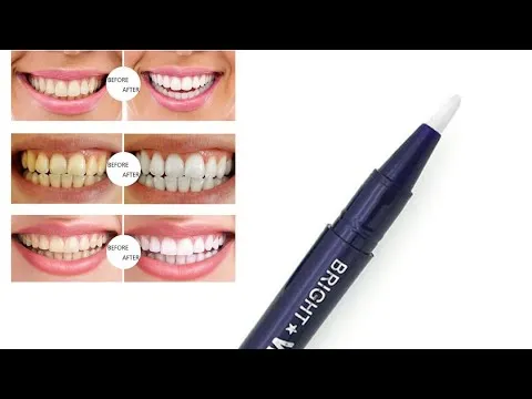25094 teeth whitening pen application