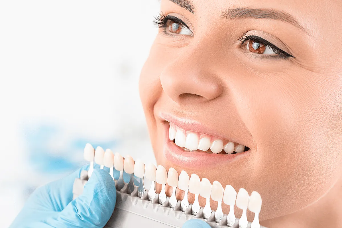 25097 in office teeth whitening