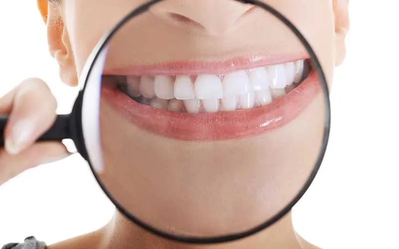 25097 oral hygiene