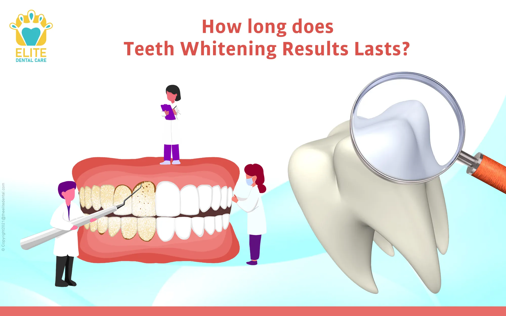 /img/25097-teeth-whitening-checkup.webp