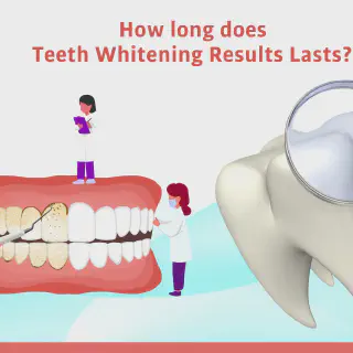 /img/25097-teeth-whitening-checkup.webp