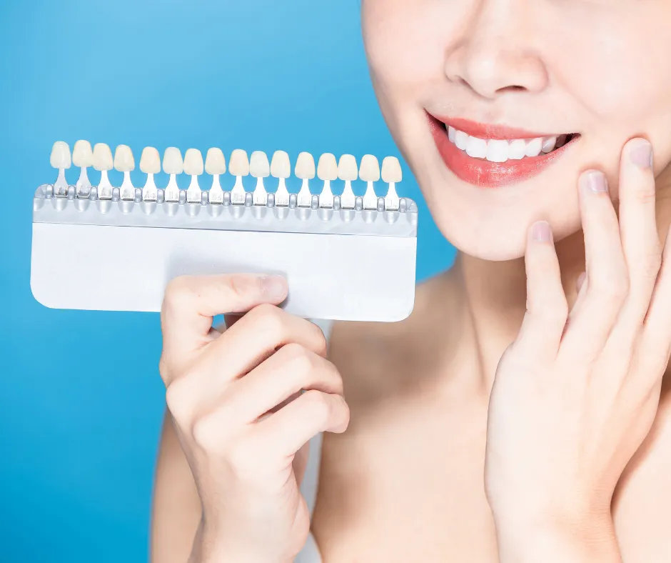 25097 teeth whitening maintenance