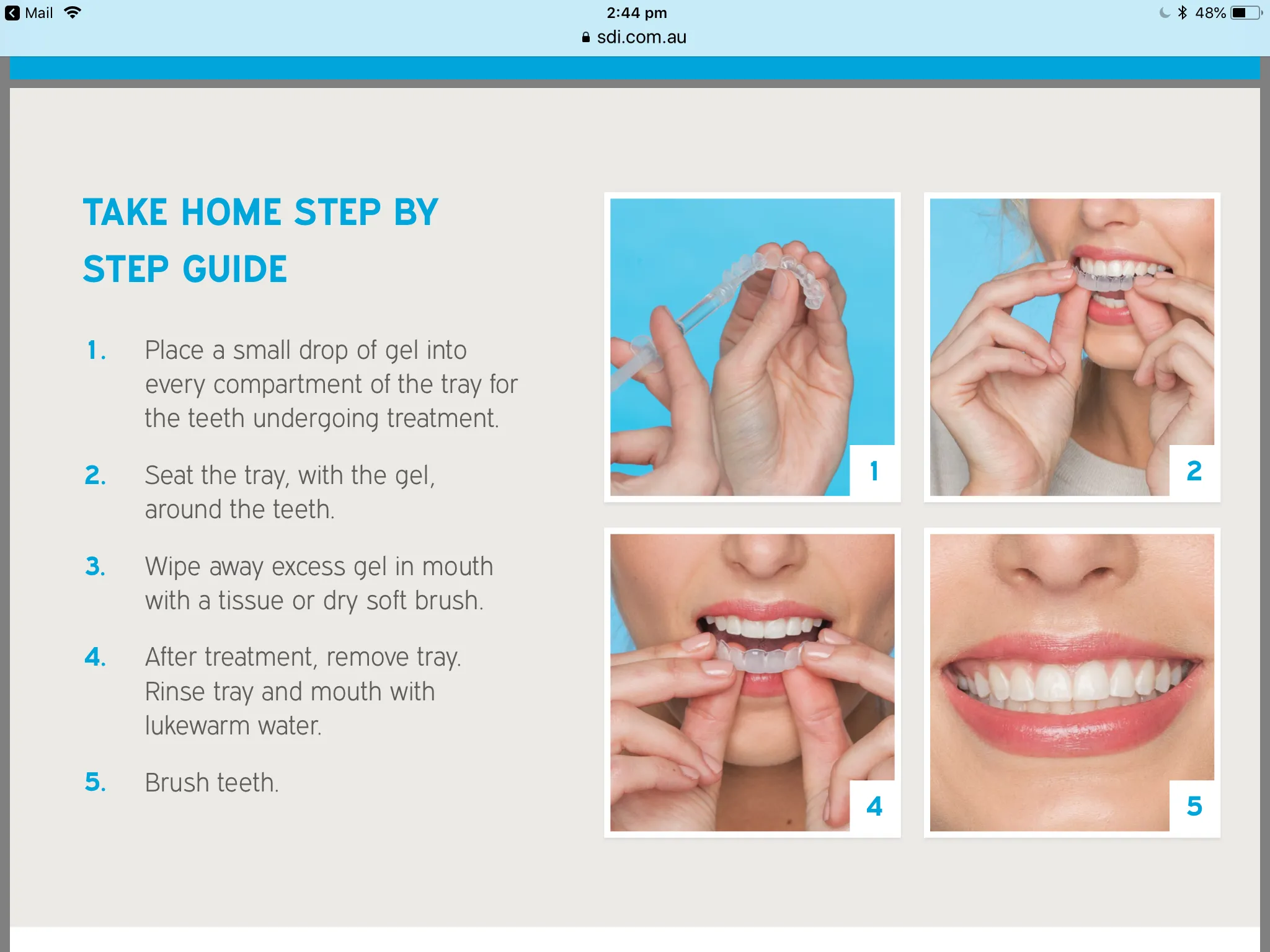 25098 whitening trays in mouth