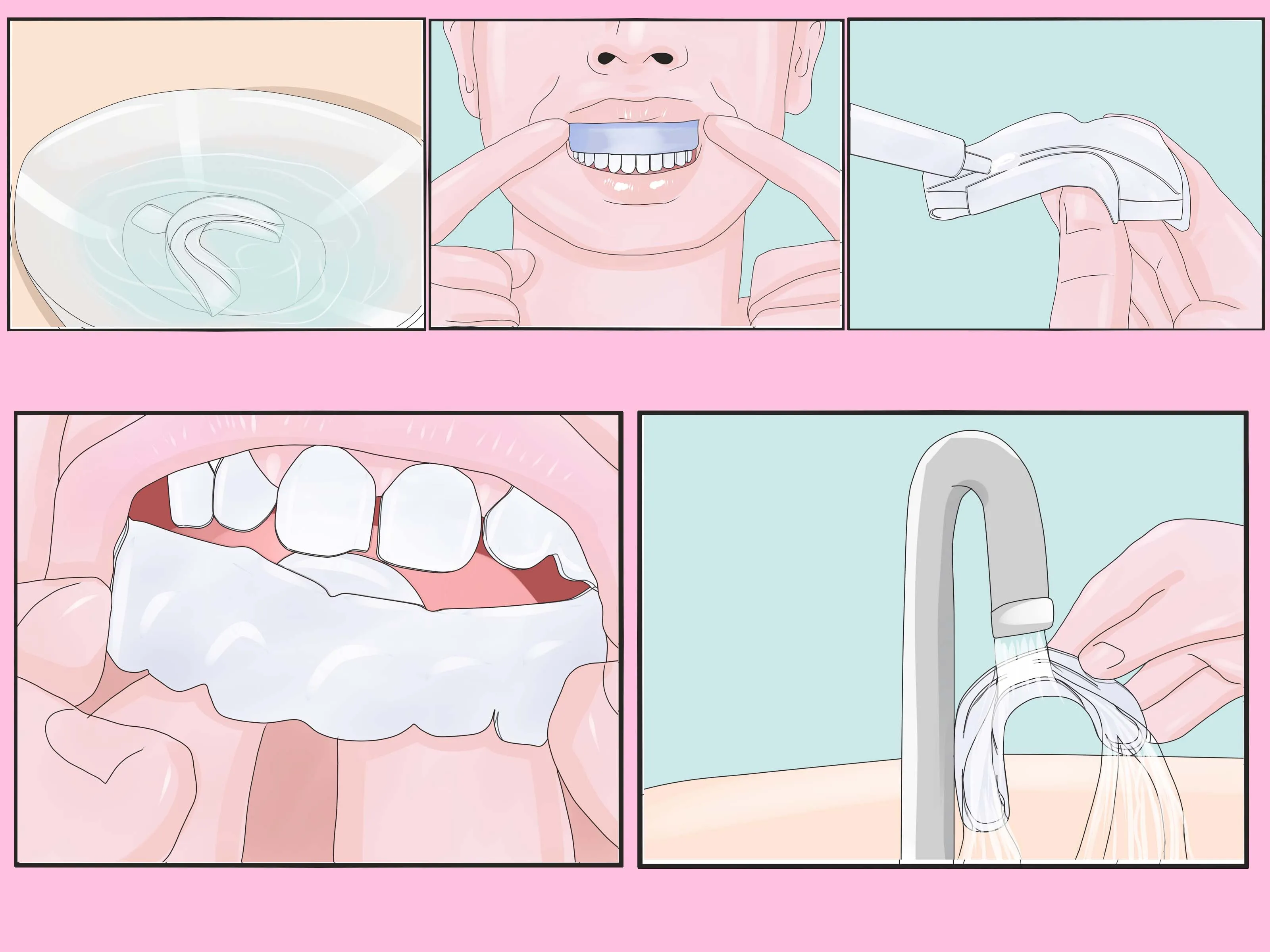 25100 teeth whitening guide