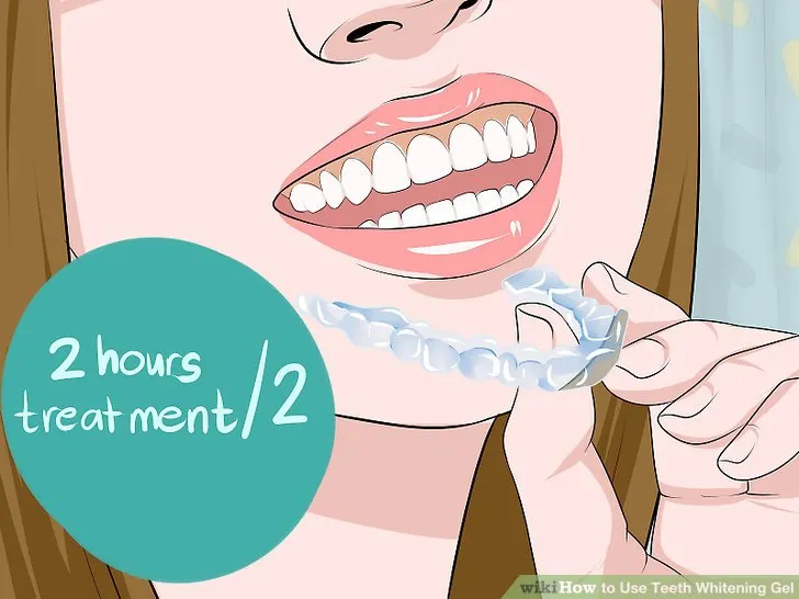 25100 types of teeth whitening gel