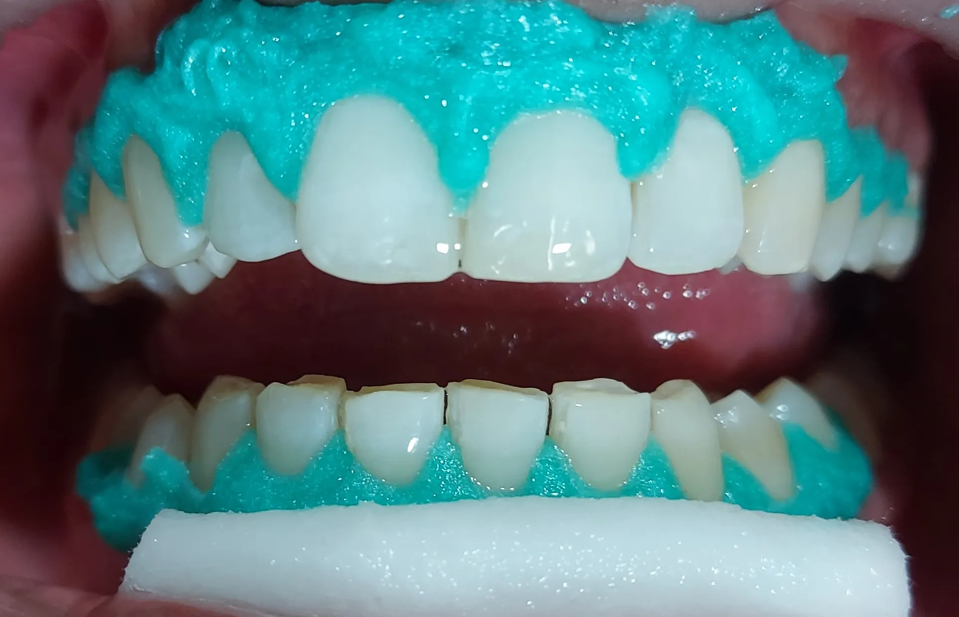 /img/25102-teeth-whitening-tips.webp
