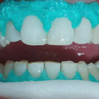 /img/25102-teeth-whitening-tips.webp