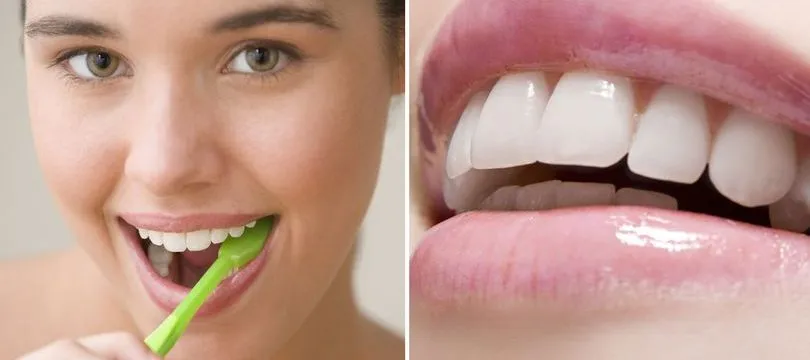 25103 teeth whitening diet