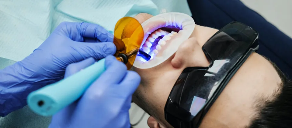 25104 in office teeth whitening 3