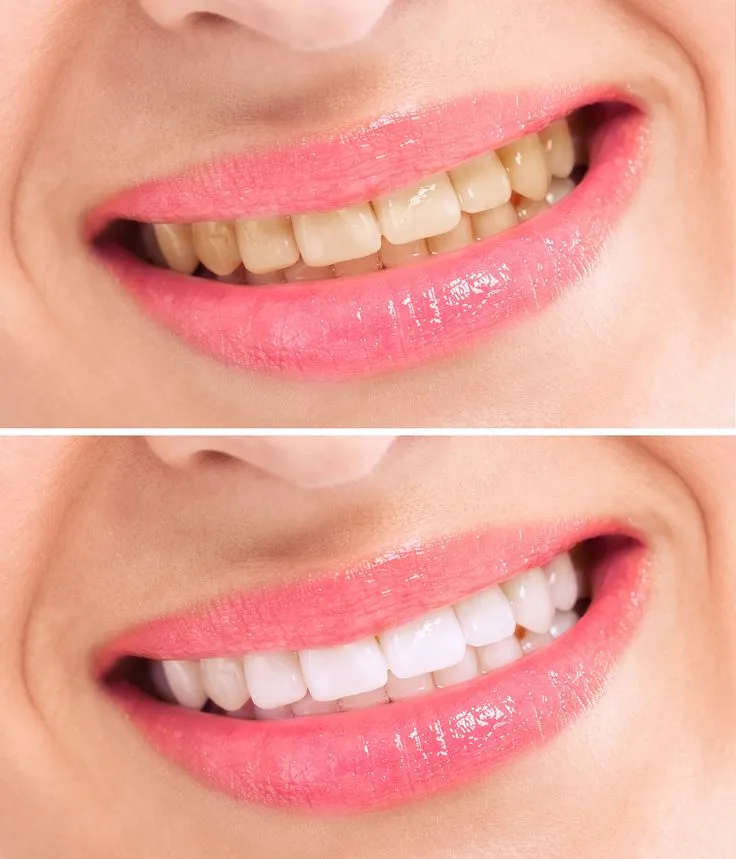 /img/25107-healthy-smile.webp