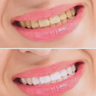 /img/25107-healthy-smile.webp