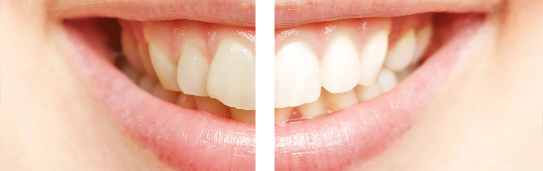 25108 choosing dentist st louis