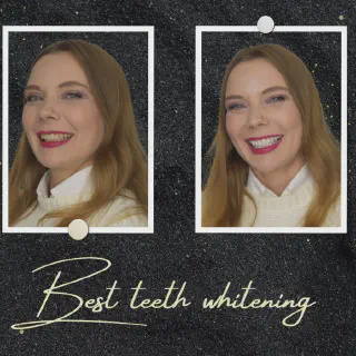 /img/25112-teeth-whitening-product.webp