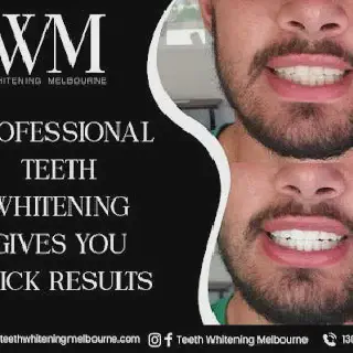 /img/25114-teeth-whitening-results.webp