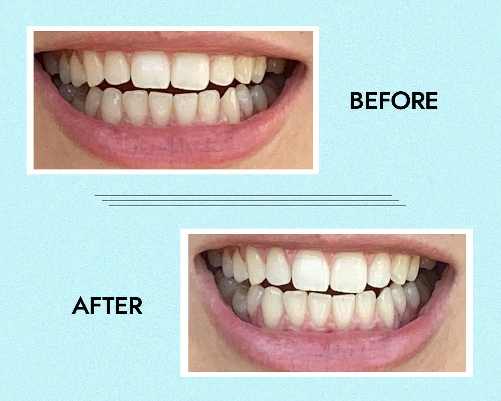 25116 brushing and flossing
