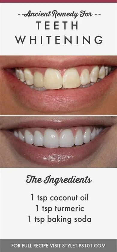 25118 dentin sensitivity