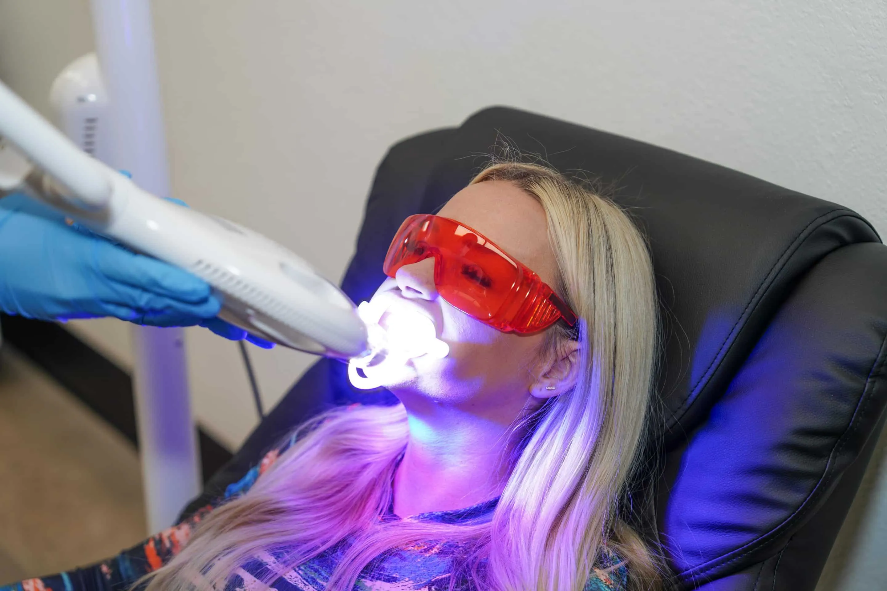 25124 fleek teeth whitening orem utah whitening gel