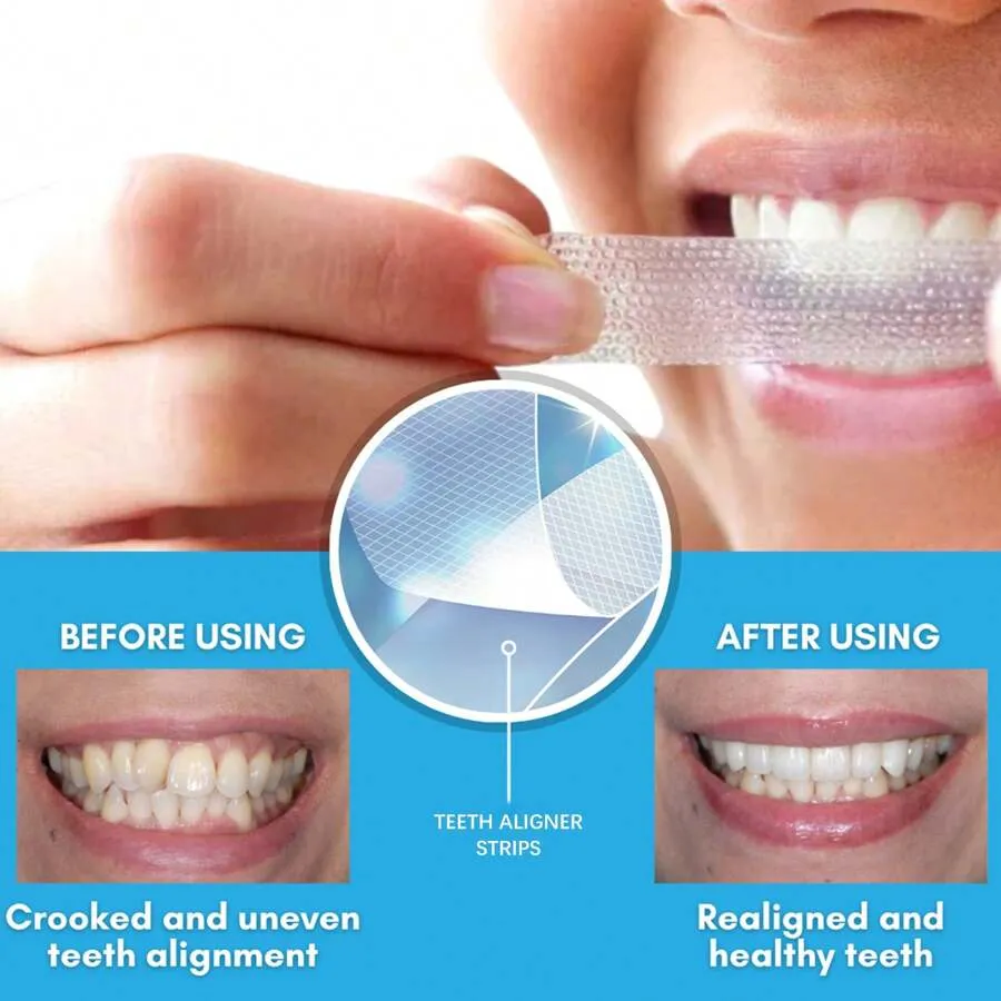25126 whitening strips application