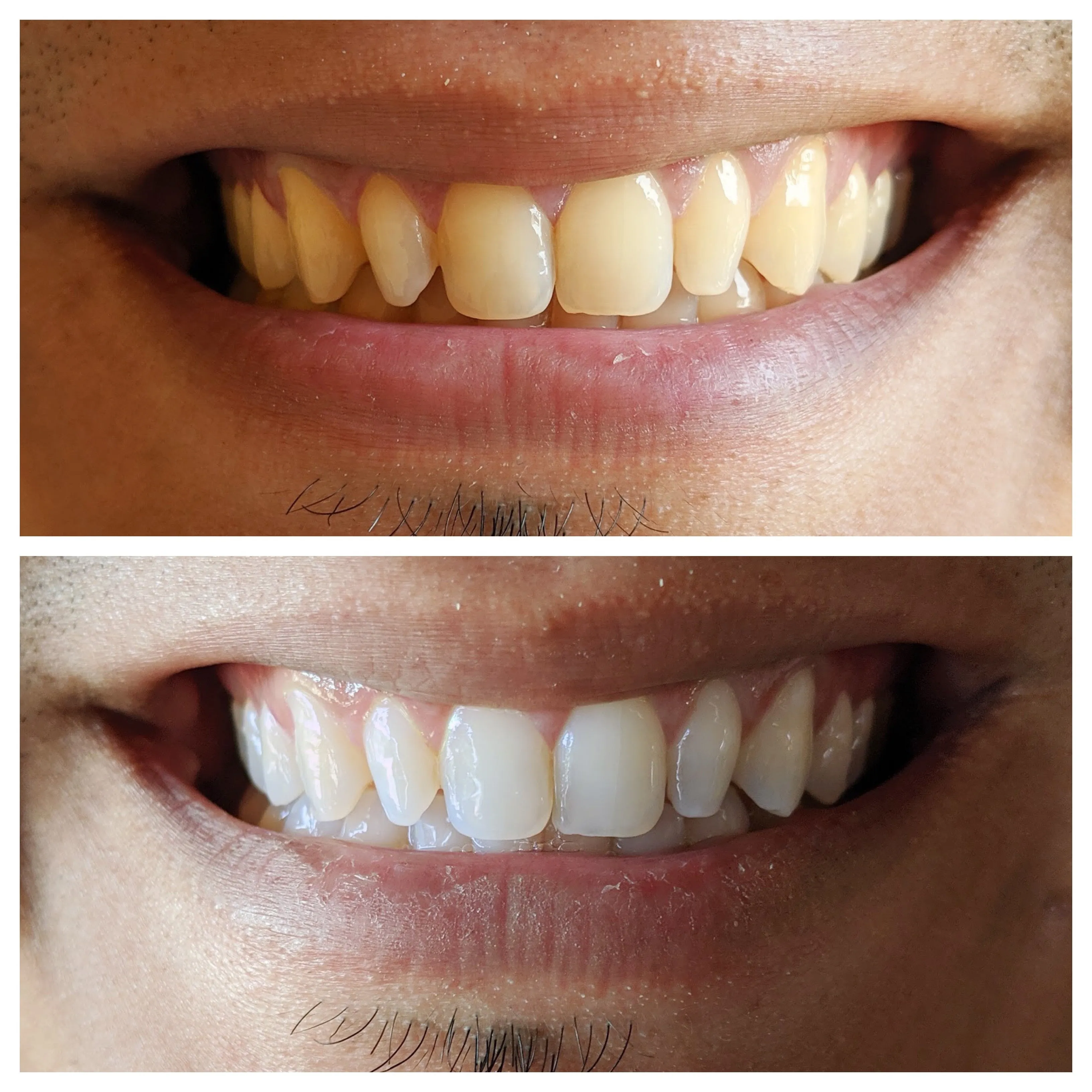 25129 colgate whitening effects