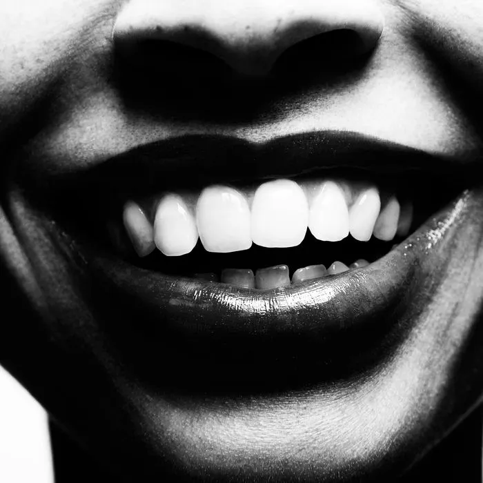 25130 safe teeth whitening
