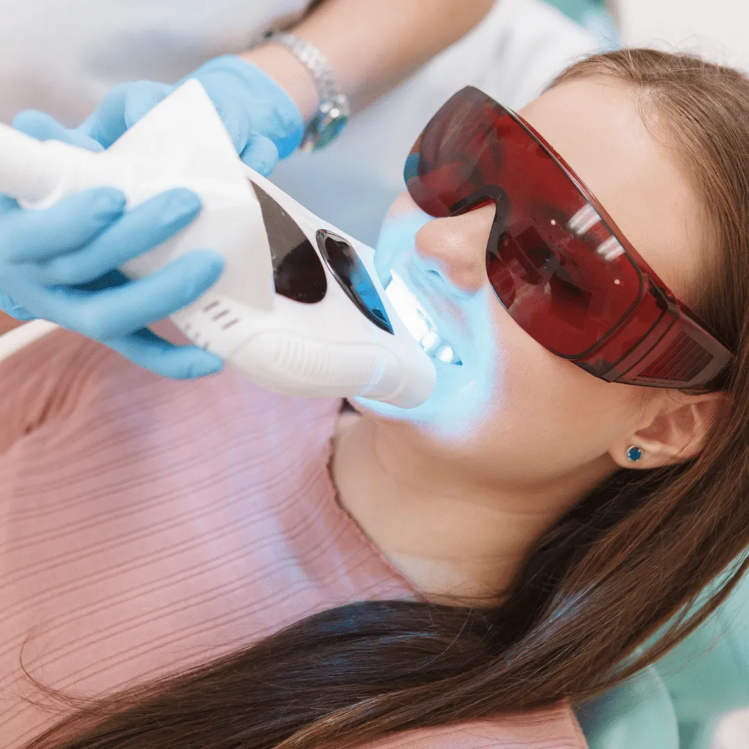 25134 zoom whitening tampa dentist