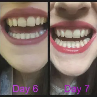 /img/25136-dental-checkup.webp