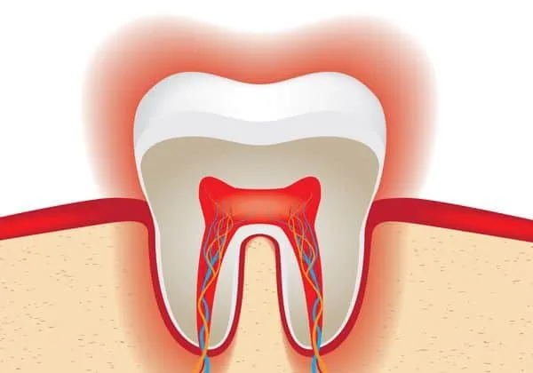 25136 tooth enamel
