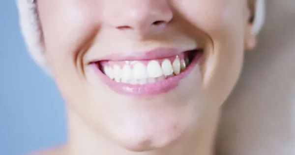 25141 dentist consultation teeth whitening
