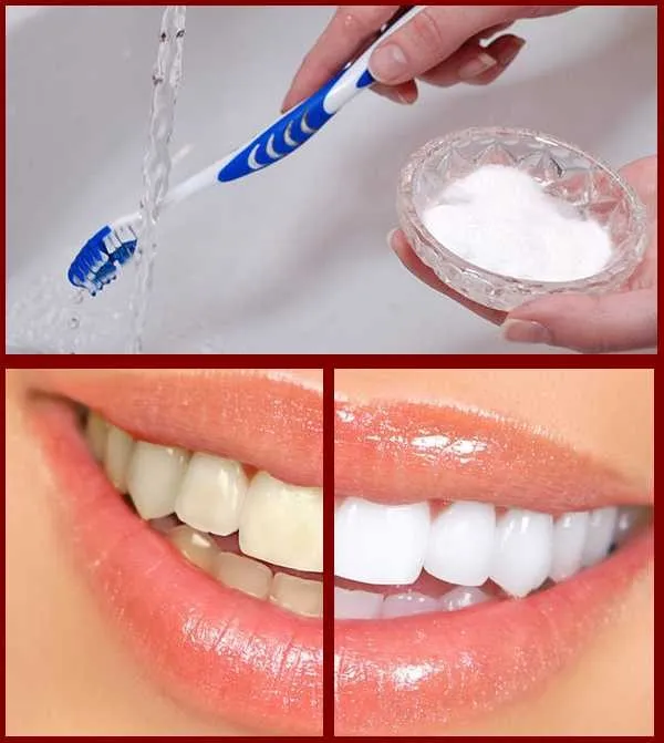 /img/25142-oral-hygiene-tools.webp