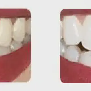 /img/25145-beautiful-white-teeth.webp