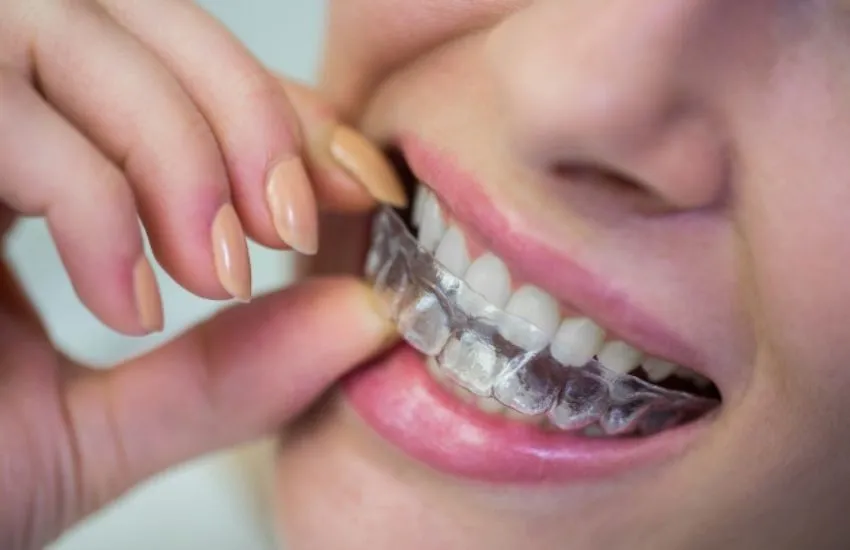 25146 teeth whitening malaysia image4