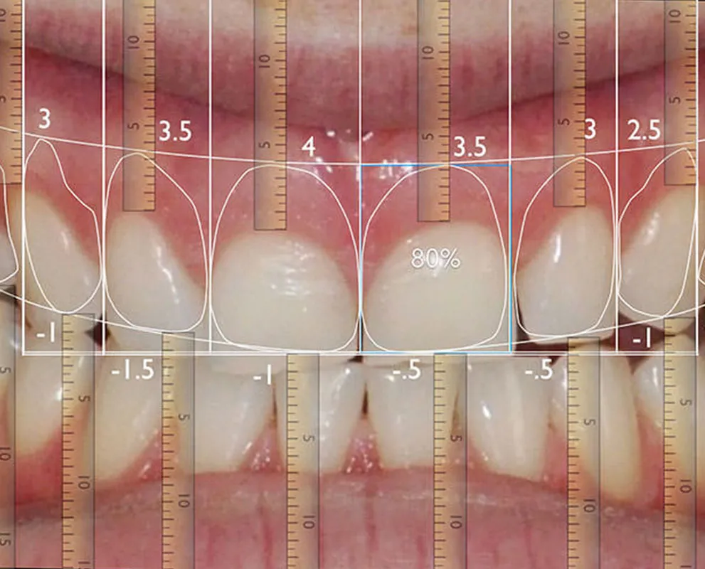 /img/25146-teeth-whitening-malaysia-image7.webp