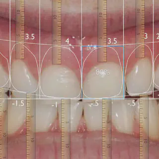 /img/25146-teeth-whitening-malaysia-image7.webp